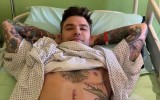 Fedez ancora in ospedale, è tornato in sala operatoria per un'emorragia